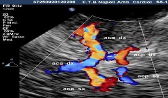 Cardio-Sonologia