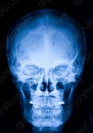 Cranio