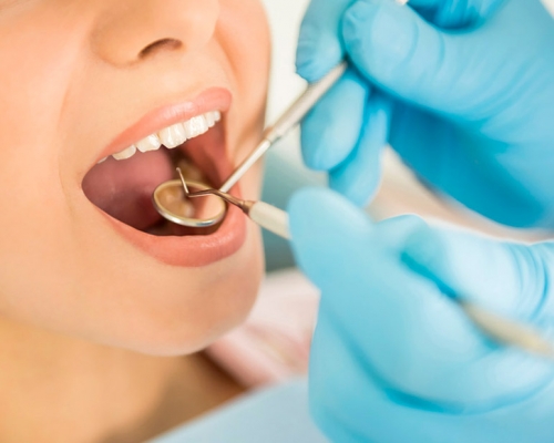 Estrazione dente